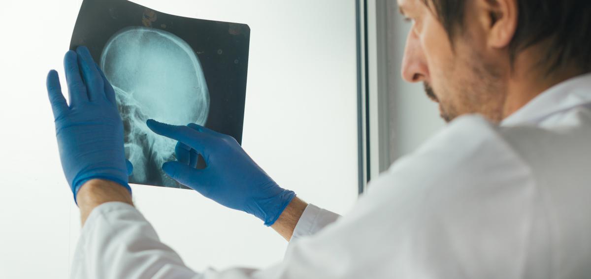 doctor examining xray of a skull